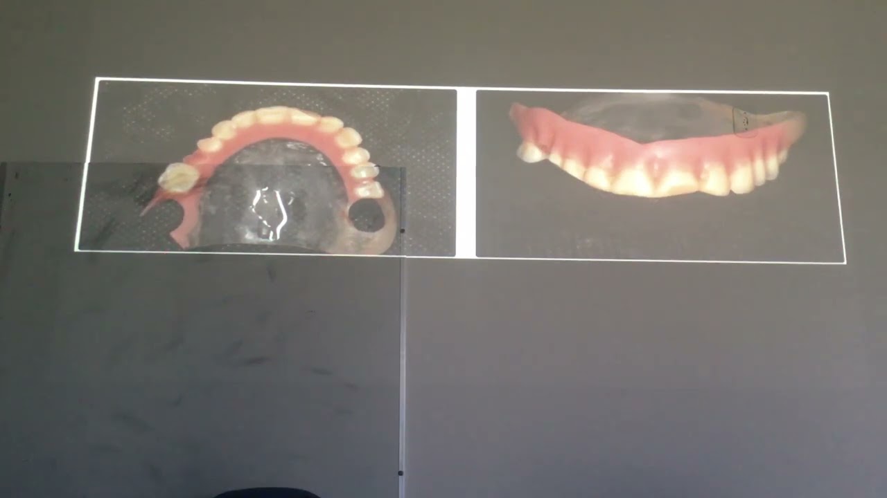 26. Montagem e ajuste dos dentes artificiais em PPR. Prof. Eduardo Chorres DOL-UFS 10-04-23