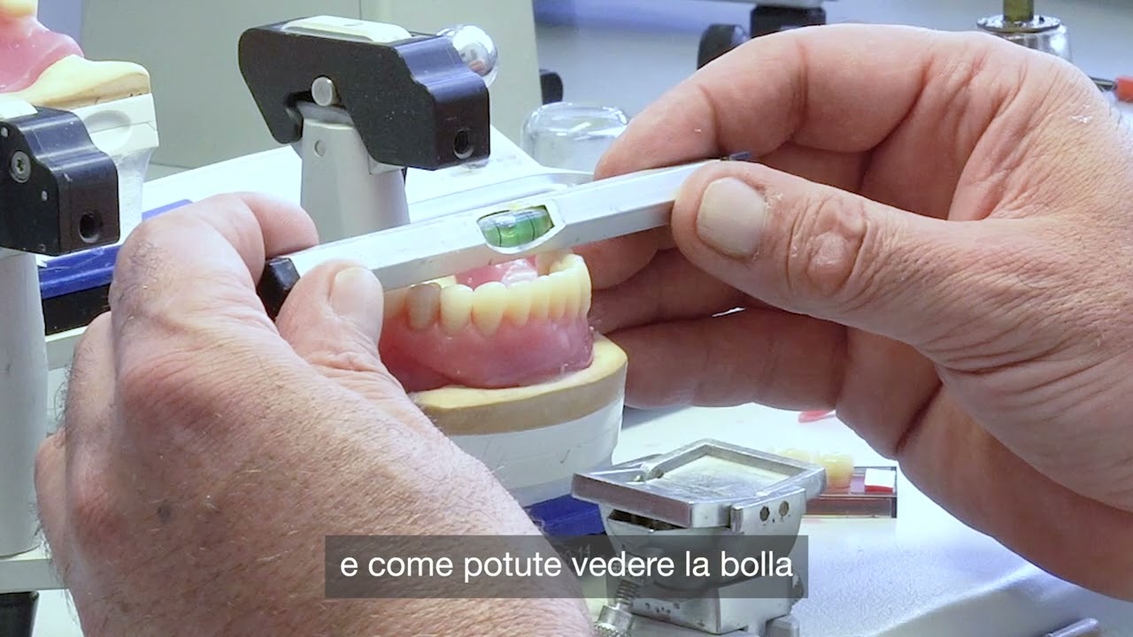 Lezione 3 | Montaggio dei denti inferiori