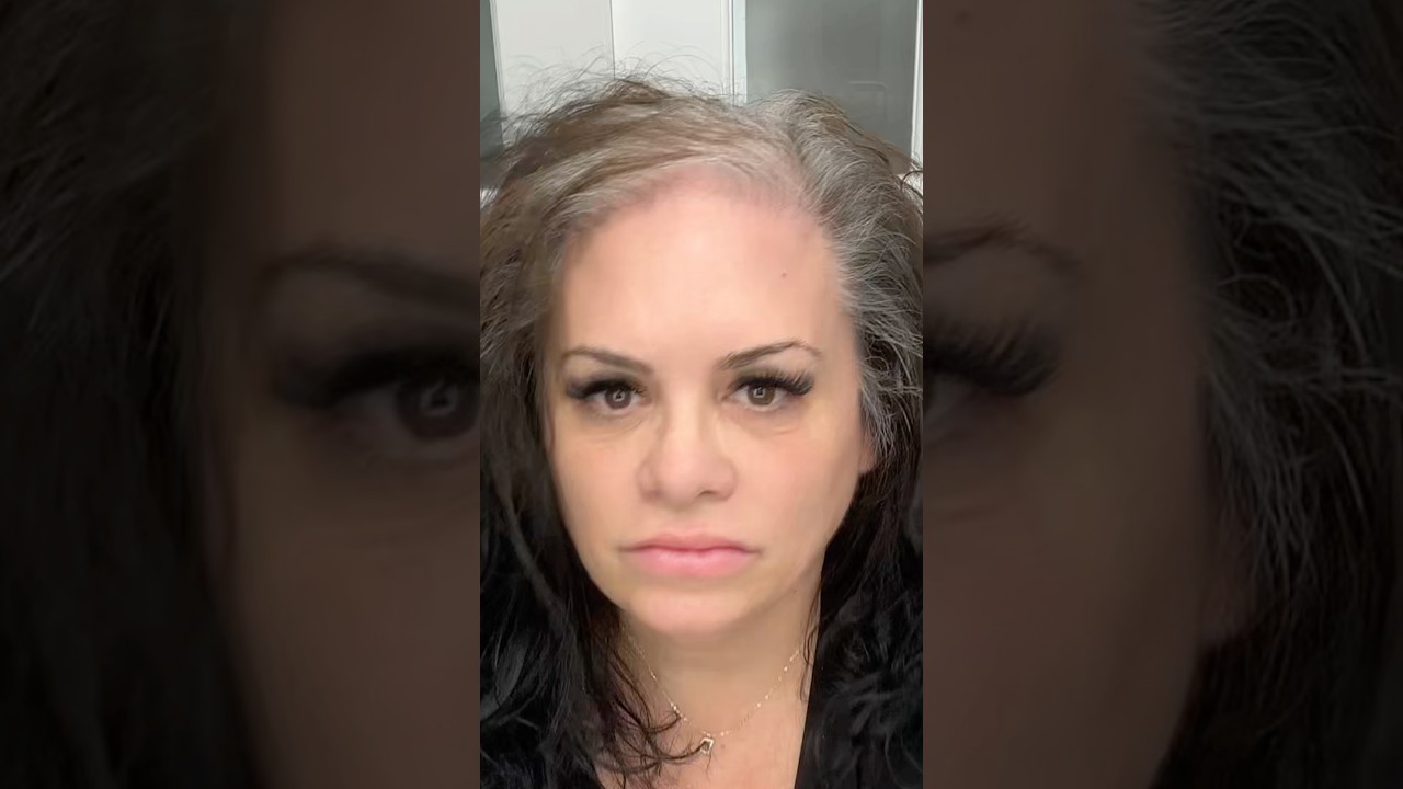 2 days after using Boldify products what really happened