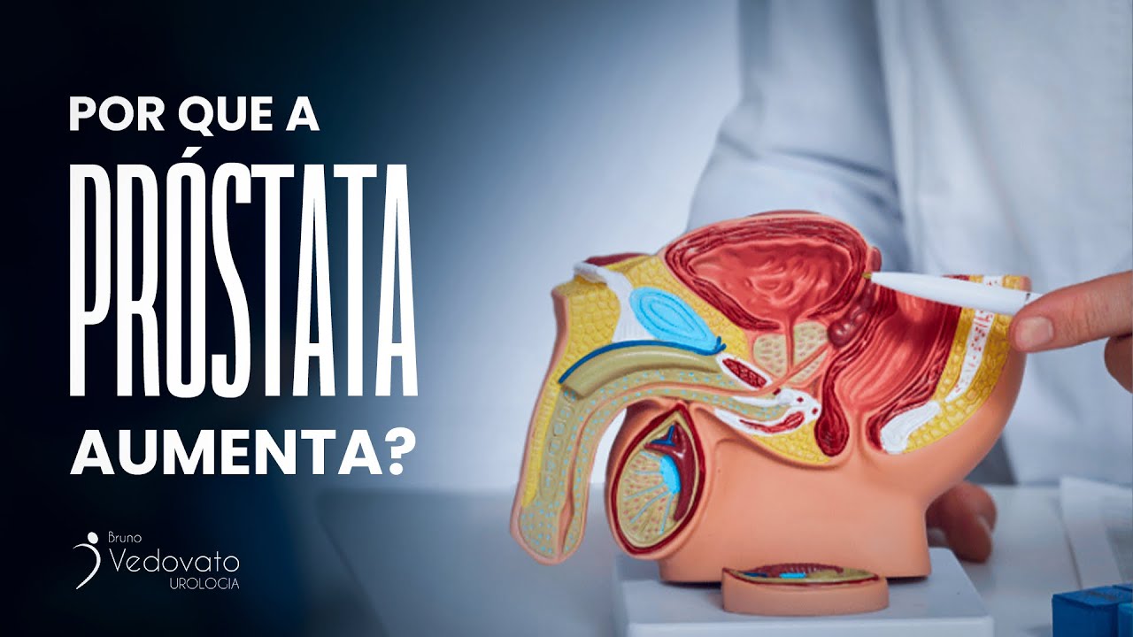 Descubra as Razões por Trás do Aumento da Próstata!