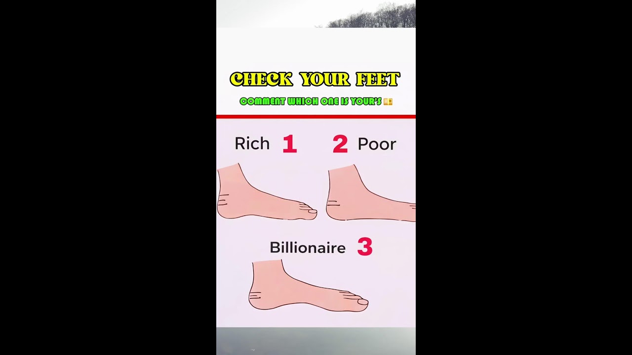What is your status?