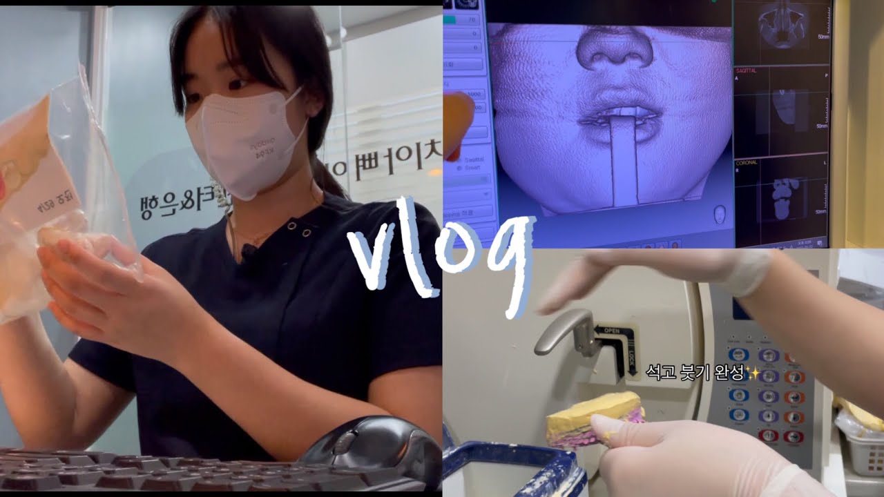 vlog) 치과위생사 1년차 브이로그 🧐 안되면 되게하라… 너무 웃겨서 호흡곤란오는 하루 👩🏻‍⚕️(진료준비, 마감, 발치준비, op준비, 석고붓기, 기공물정리, CT사진)