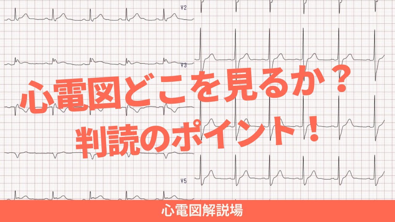 心電図解説場（心電図を見るポイント）
