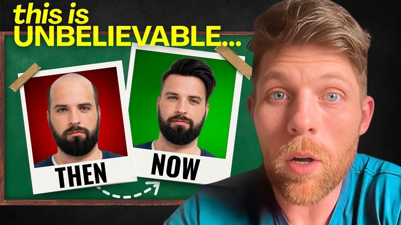 These Full Cap Hair Systems Look Too Good To Be Real