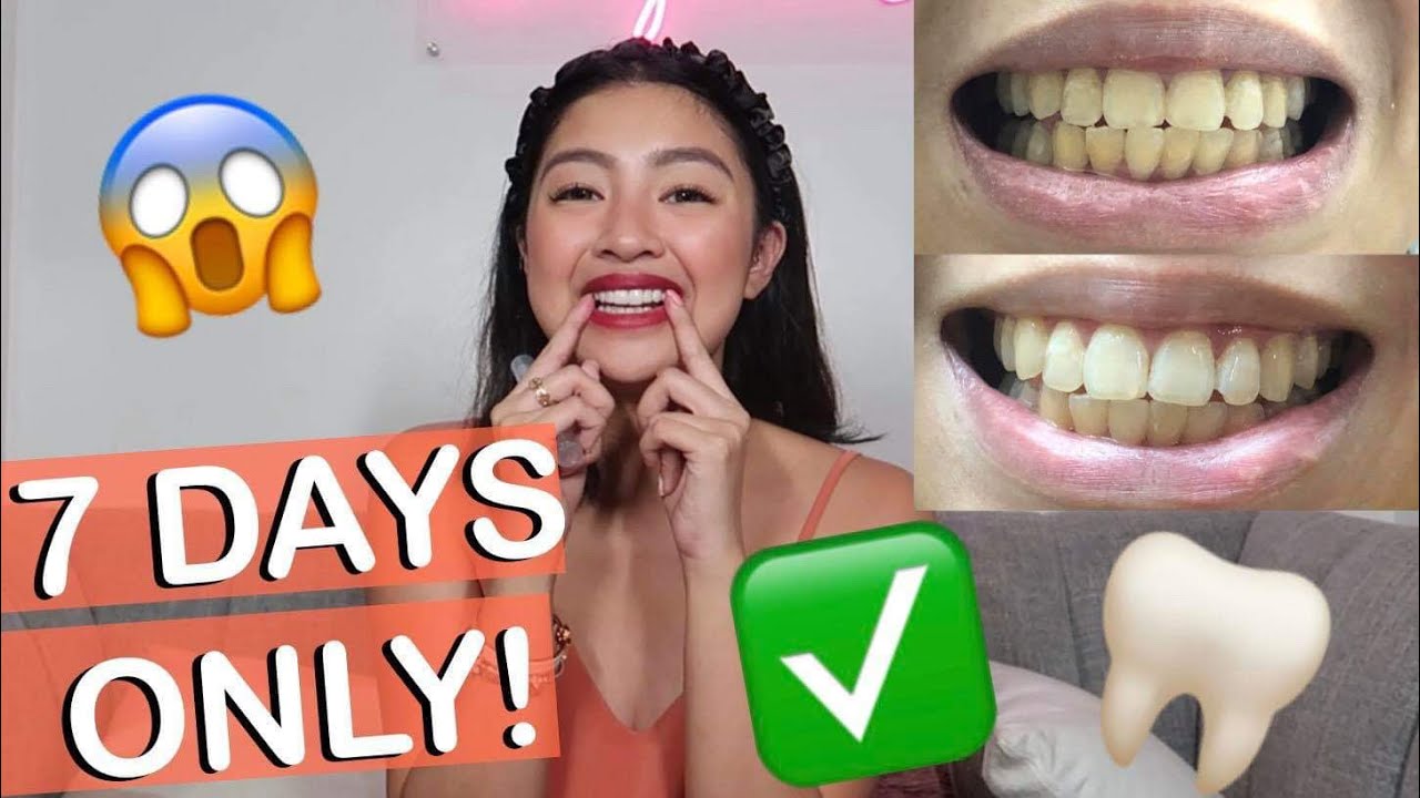 ₱300 TEETH WHITENING FROM WATSONS | Rei Germar