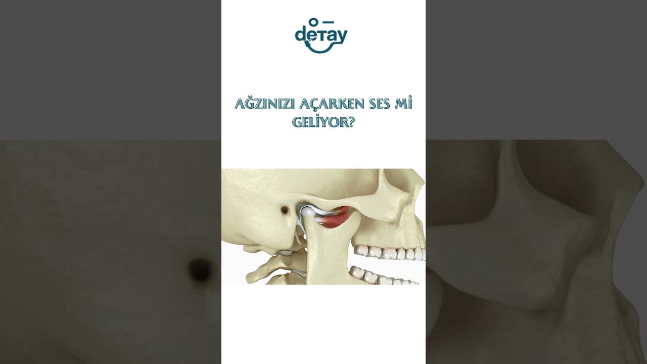 Yemek Yerken &Ccedil;ene Ağrısı Yaşıyorsanız Dikkat! 😧 #&ccedil;eneeklemi #&ccedil;enecerrahisi #ağızsesleri