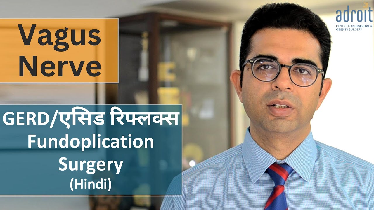 Vagus Nerve, GERD and Fundoplication Surgery Hindi
