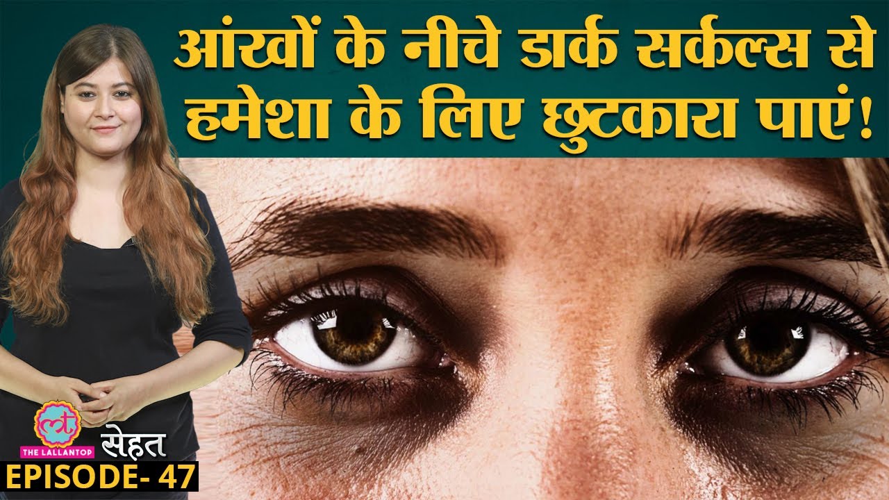 पूरी नींद होने पर भी Dark Circles यानी आंखों के नीचे काले घेरे क्यों पड़ जाते हैं?| Sehat Ep 47
