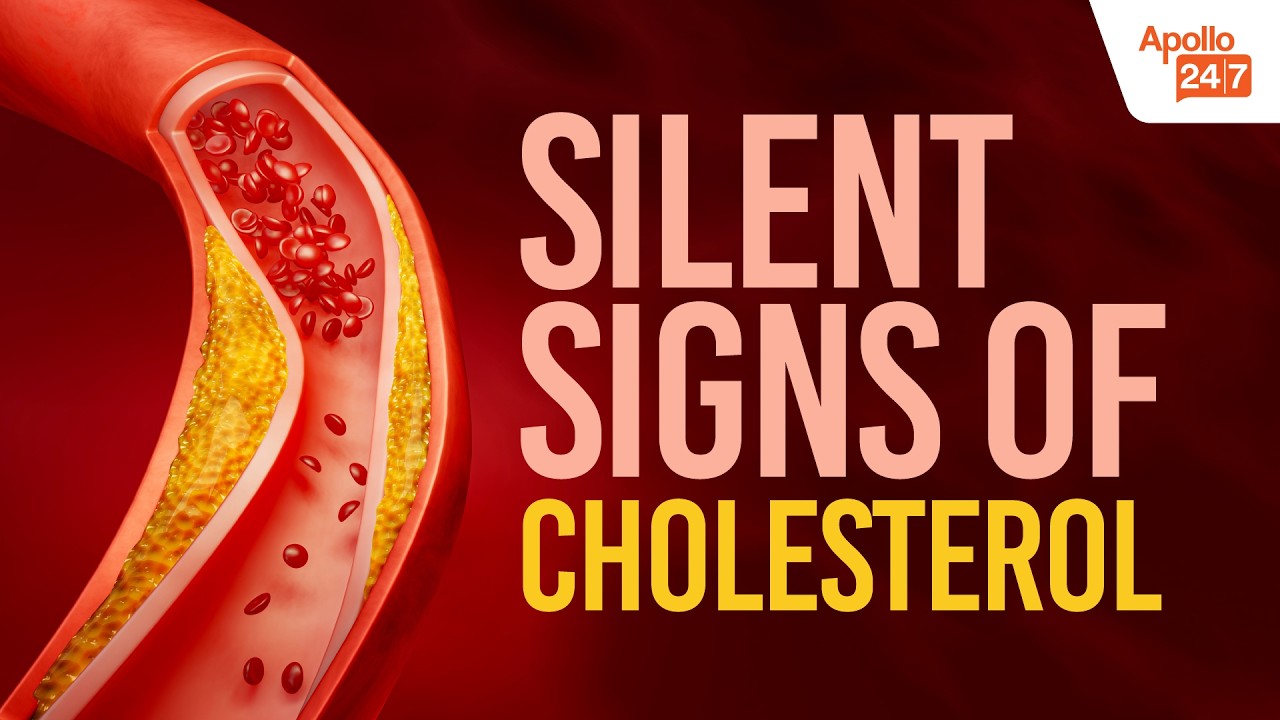 High Cholesterol Symptoms: The Hidden Warnings