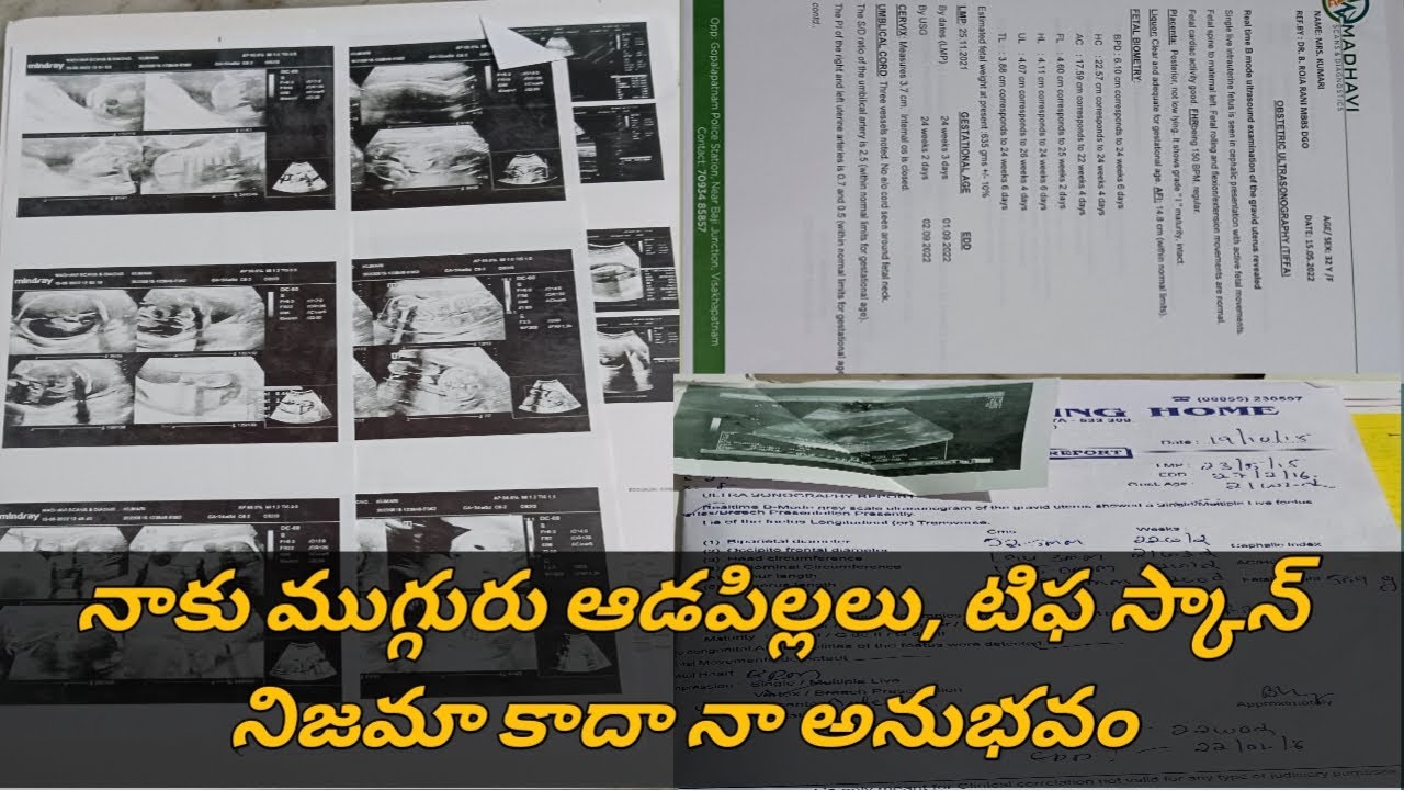 నాకూ ముగ్గురూ ఆడపిల్లలు, నా అనుభవం 3rd c-section వల్ల నరకం చూశా