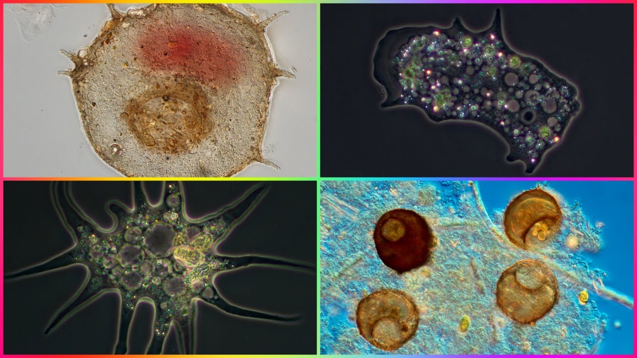 Ciclo de Vida de las Amebas ¿Qué Tipo de Reproducción Tienen las Amebas?