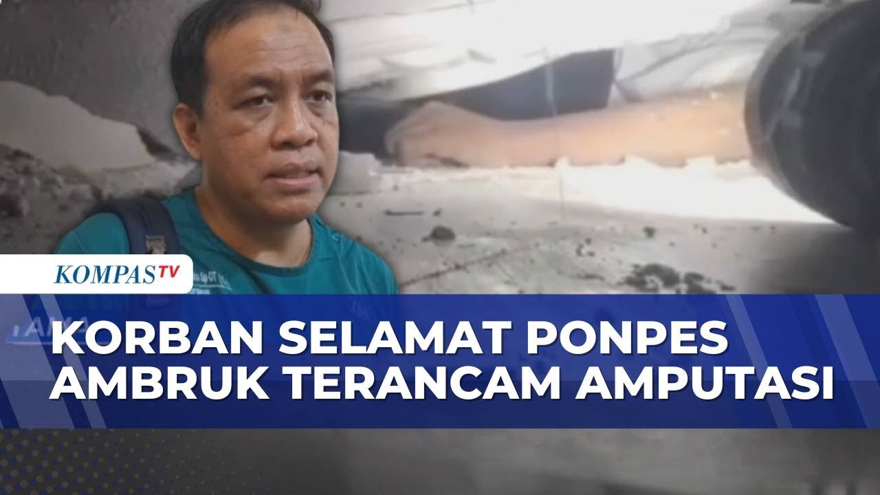 Bertahan Usai Tertimbun 48 Jam di Reruntuhan Ponpes, Haical Terancam Diamputasi | BERUT