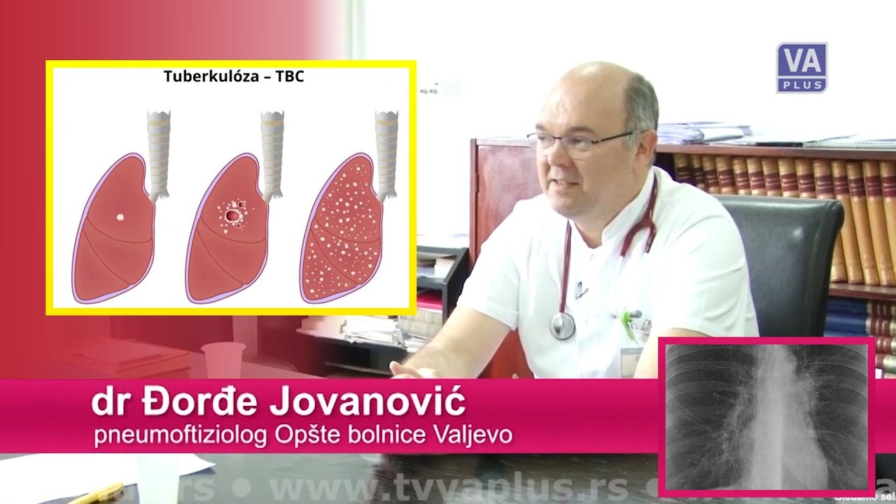 Lepeza zdravlja i lepote: Svetski dan borbe protiv tuberkuloze EP45:S01 (28-03-2019)