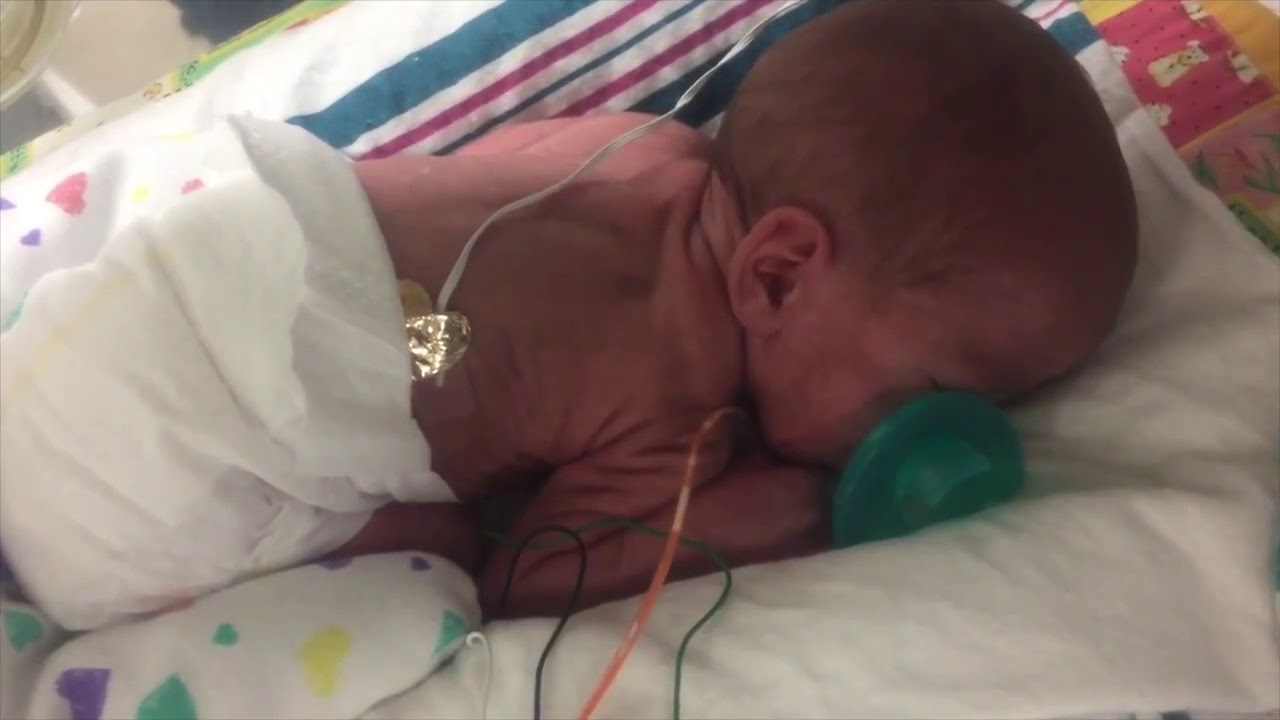Born Too Soon: Alexanders Story