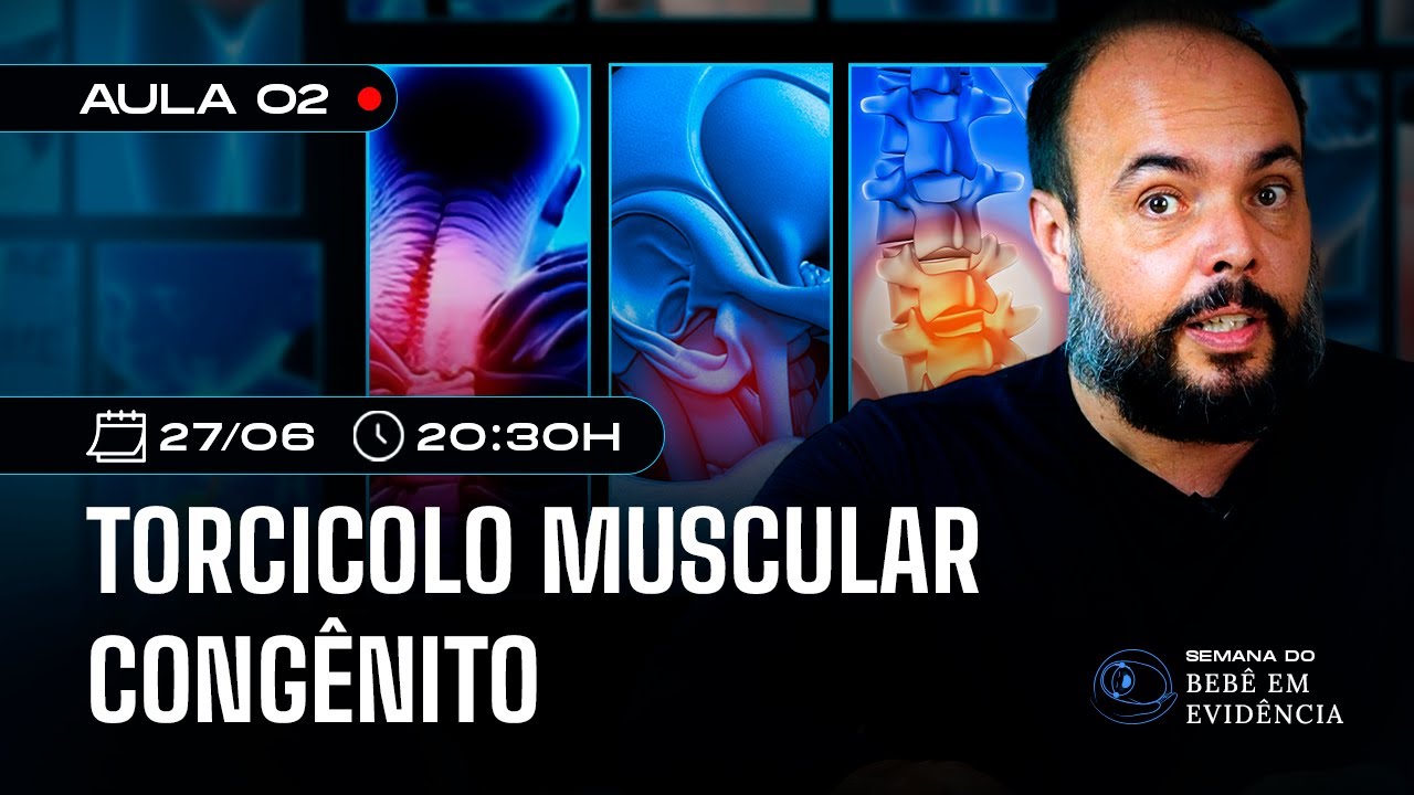 #AULA02 -  Torcicolo muscular congênito (As evidências mais atuais) - Semana do Bebê em Evidência