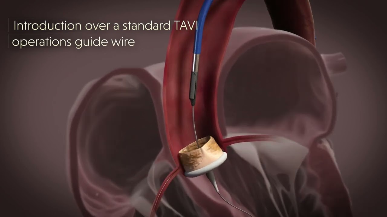 H.V.T medical by MVR