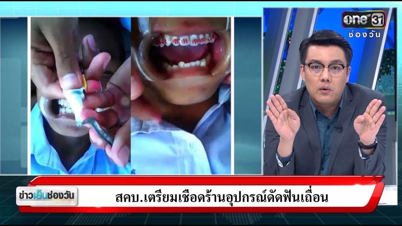 สคบ.เตรียมเชื่อดร้านอุปกรณ์ดัดฟันเถื่อน | จั๊ด ซัดทุกความจริง | ข่าวช่องวัน | ช่อง one31