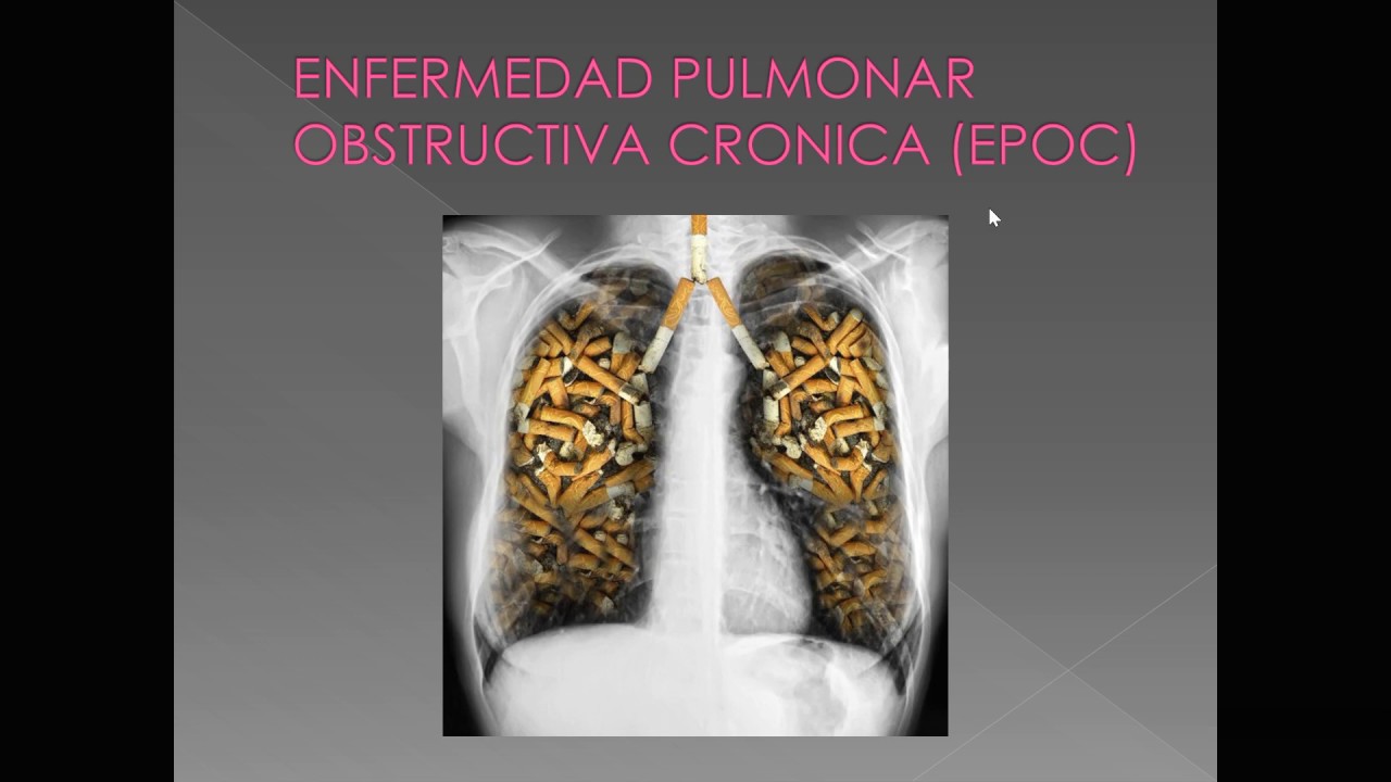 Enfermería - Adulto y Anciano - EPOC