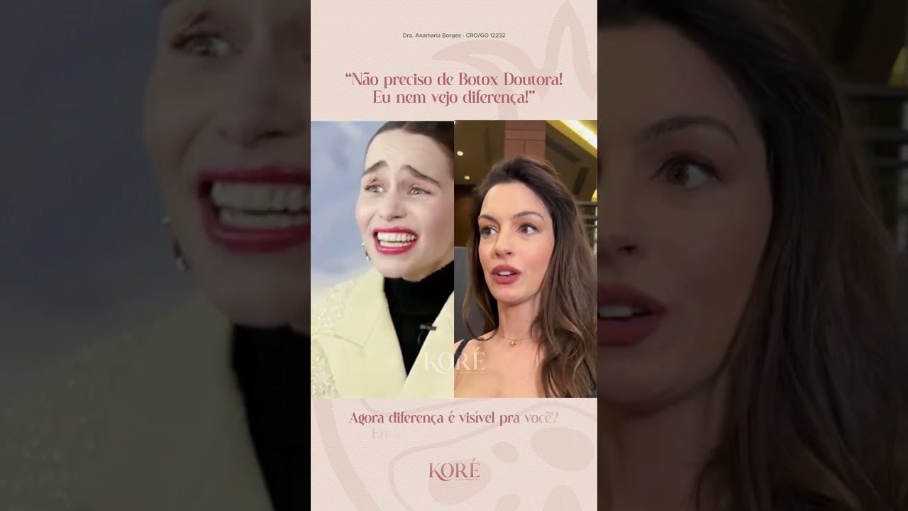 Vamos falar de express&atilde;o facial e rejuvenescimento? Duas atrizes, uma diferen&ccedil;a vis&iacute;vel!🪞