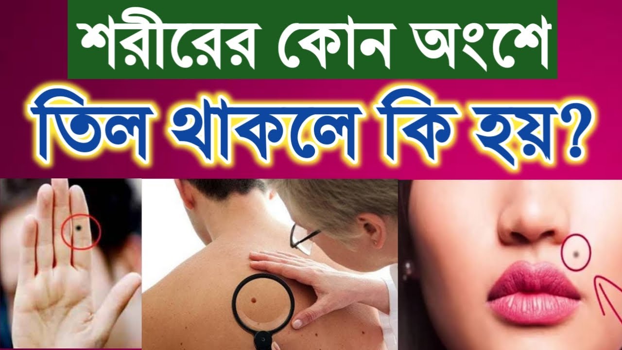 শরীরের কোন অংশে তিল থাকলে কি হয় | Sorirer kothay til thakle ki hoy | Facts Explained