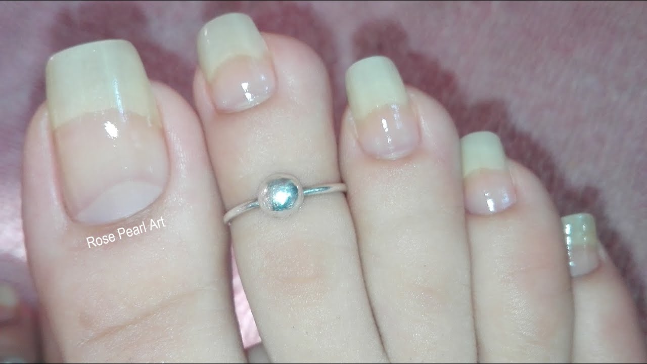 What to do When Your Toe Nails Start Bending When They Grow? DIY Tips | Rose Pearl