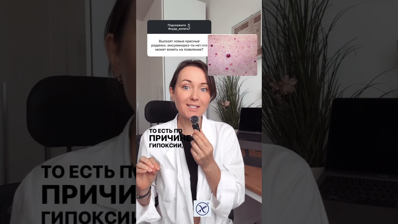 Красные РОДИНКИ/ причины