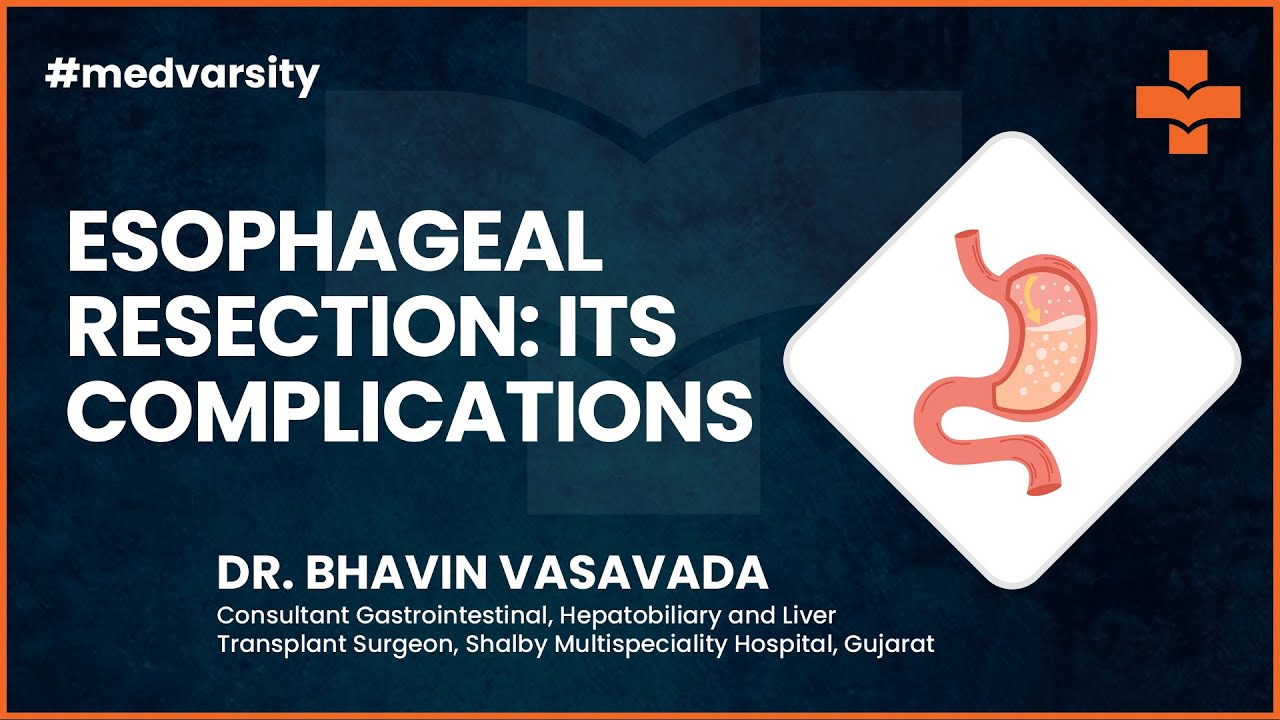 Esophageal Resection & its Complications | @MedvarsityTechnologiesPvtLtd