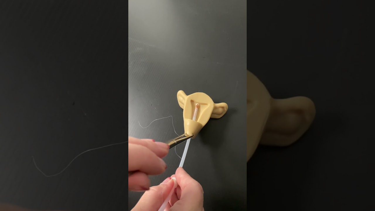 IUD insertion