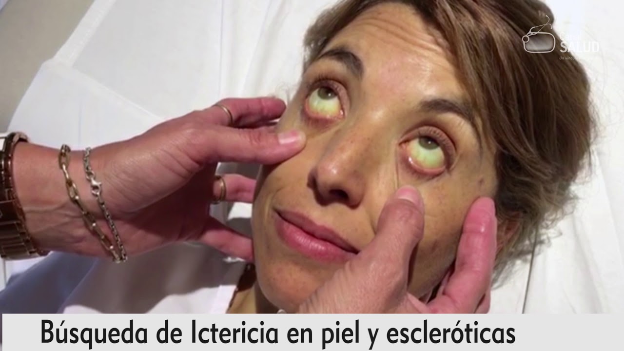 Caso Clínico 1 - Aparato Digestivo