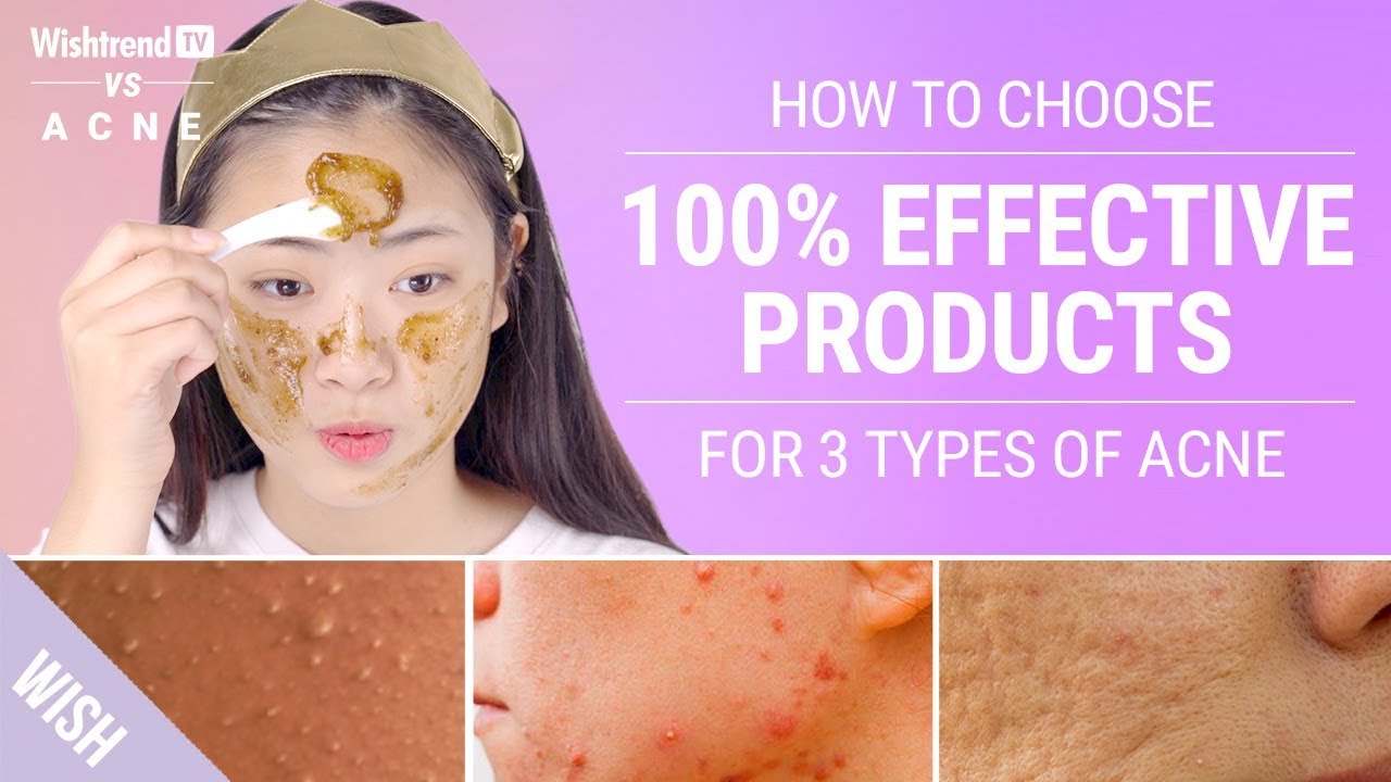How to Choose Skincare That Really Works for 3 Different Types of Acne | WishtrendTV VS ACNE
