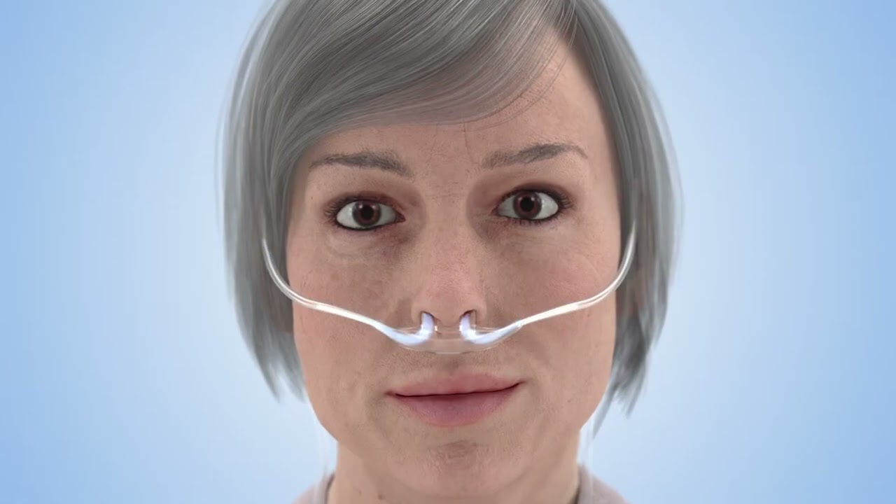 Concentrador de oxígeno Caire® Freestyle Comfort - Promoción