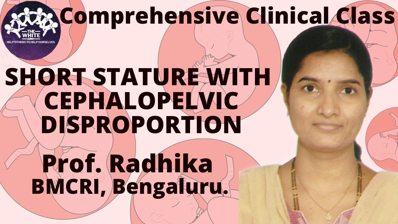 Short Stature with Cephalopelvic Disproportion Case Presentation
