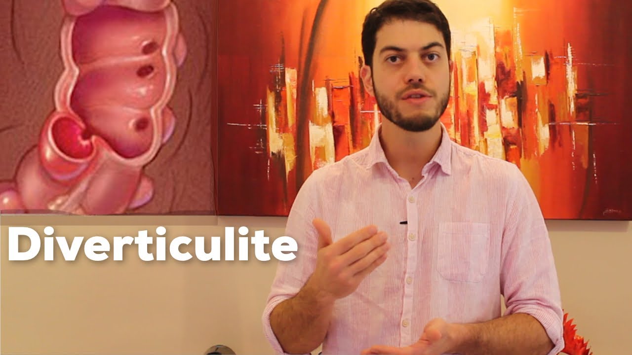O que &eacute; diverticulite? Como &eacute; o tratamento?