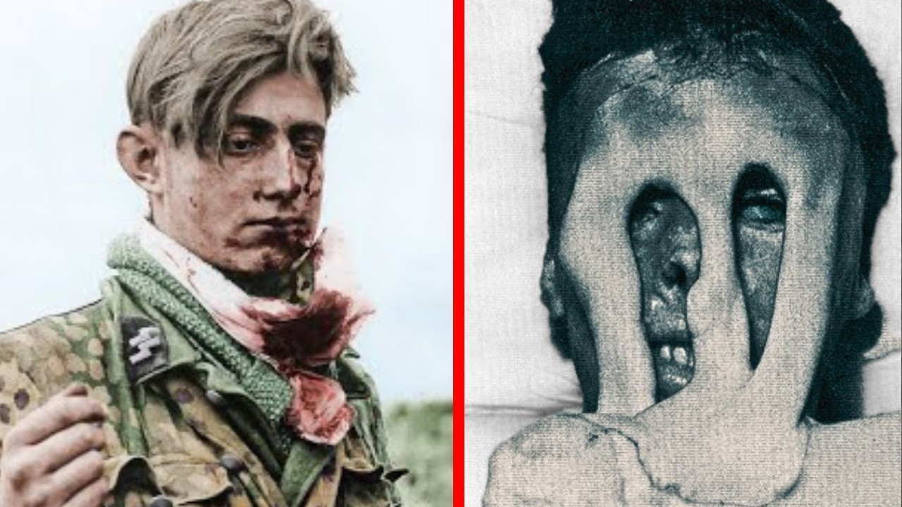 The HORRORS of Chemical Weapons in WW2 *WARNING Disturbing Historical Content