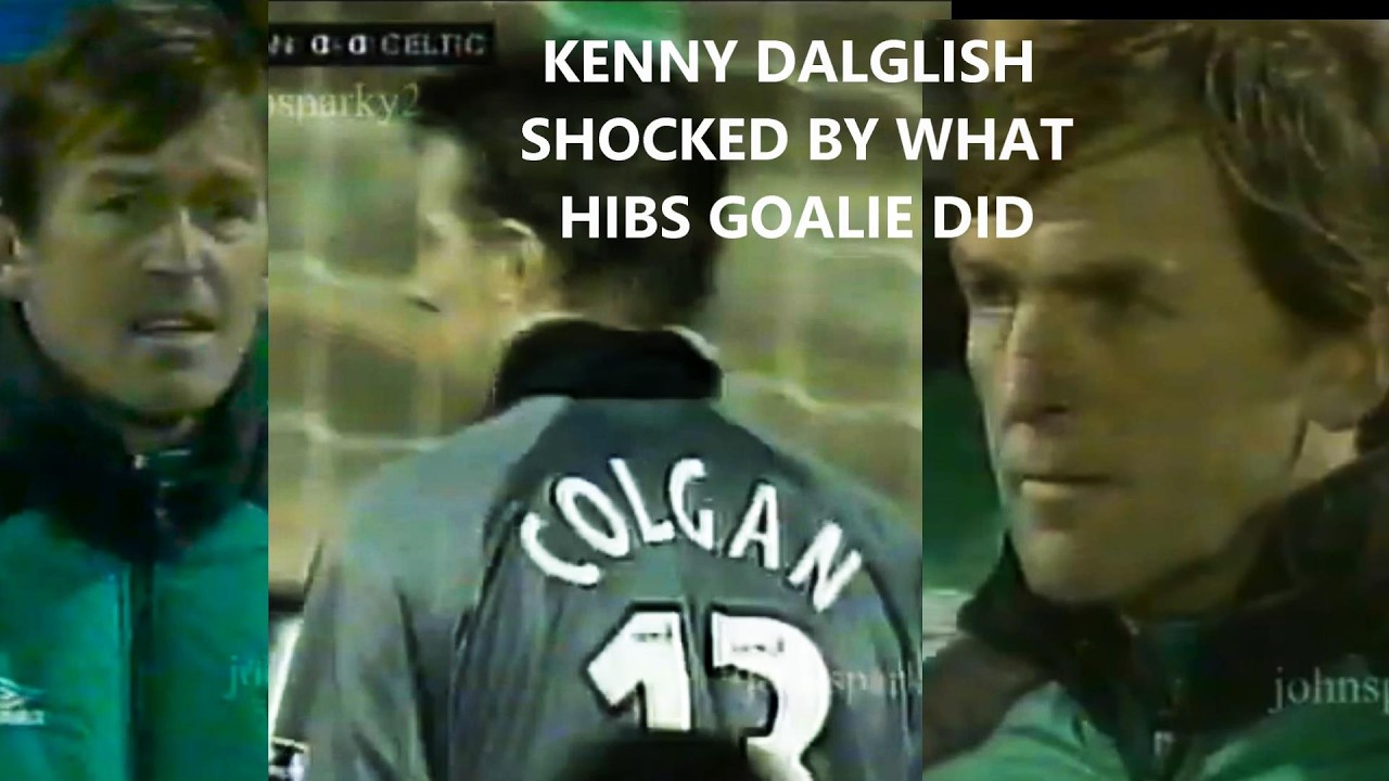 KENNY DALGLISH SHOCKED BY WHAT THE HIBS GOALIE DID