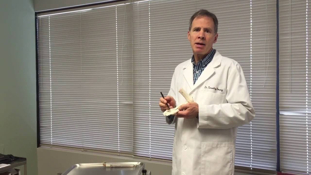 How a Cheilectomy Procedure is Done