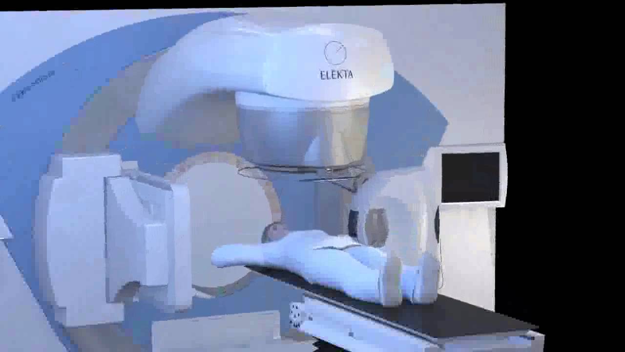 GRAACC | Institucional | Como Funciona o Equipamento de Radioterapia