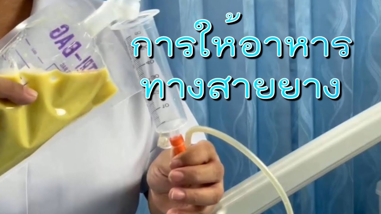 การให้อาหารทางสายยาง