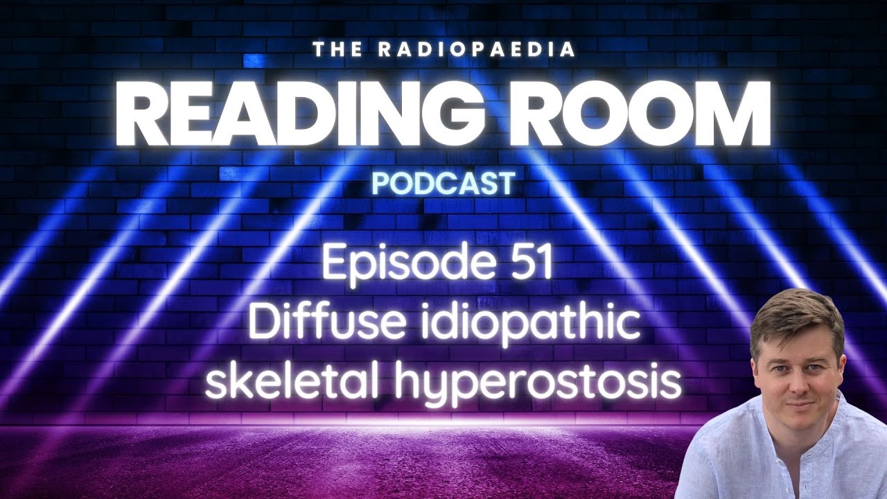 Diffuse idiopathic skeletal hyperostosis with Andrew Dixon