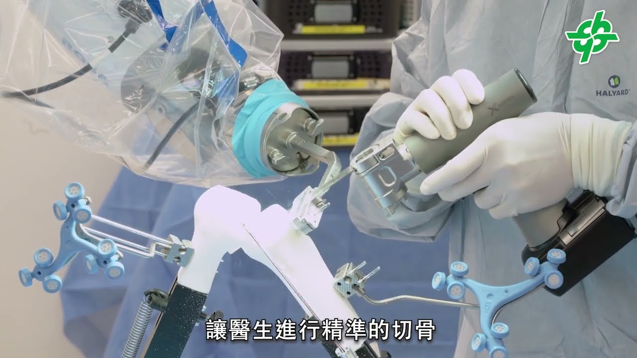 【🏥#浸醫同行｜骨科篇】機械臂輔助全膝關節置換手術🦵🏻🦵🏻