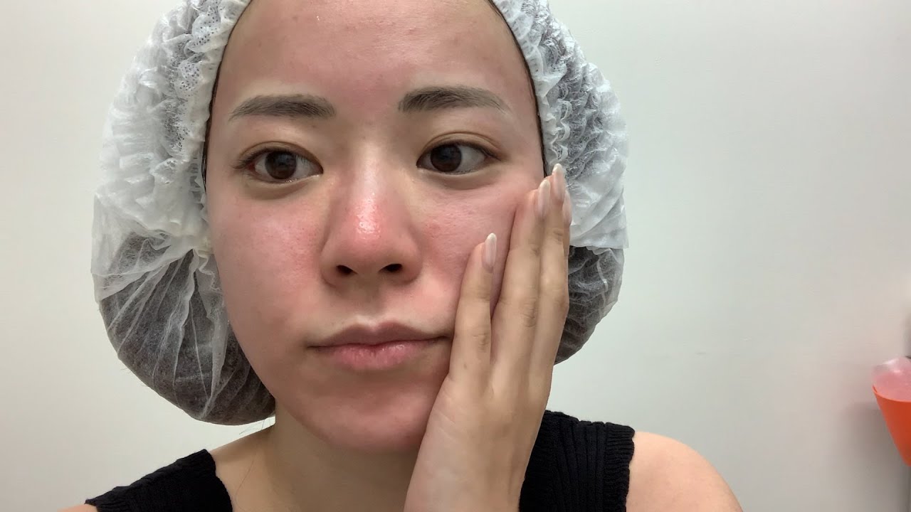 痛すぎて、まさに顔面デスソース。