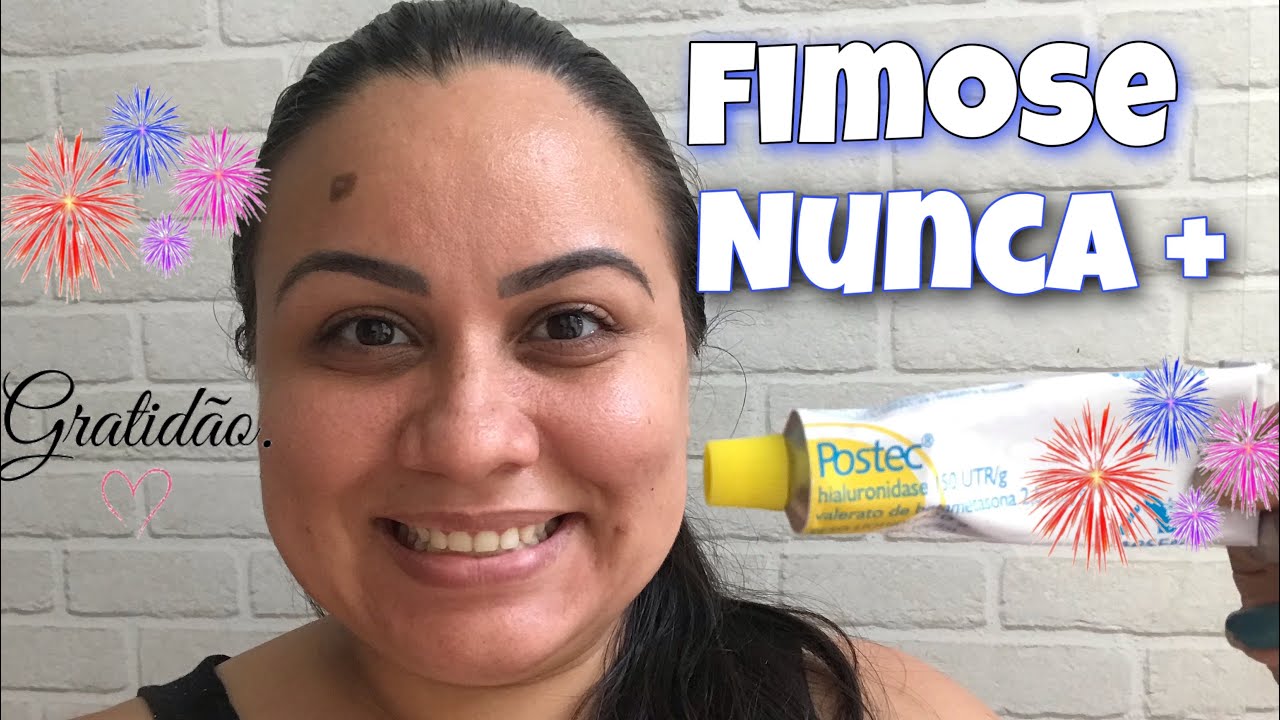 COMO USAR A POMADA POSTEC?!E SE LIVRAR DA CIRURGIA/ Sarou a fimose do meu filho😃🙏assista at&eacute; final