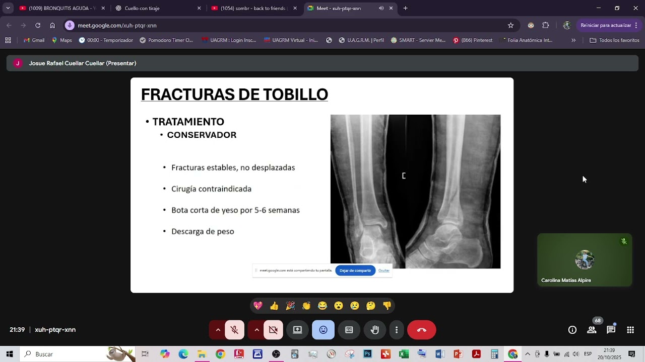PRACTICA MMII PIE 2