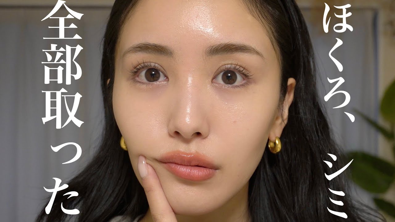 ほくろ除去とシミ取りしたのでリアルな経過レポ👀クリニックも公開🏥
