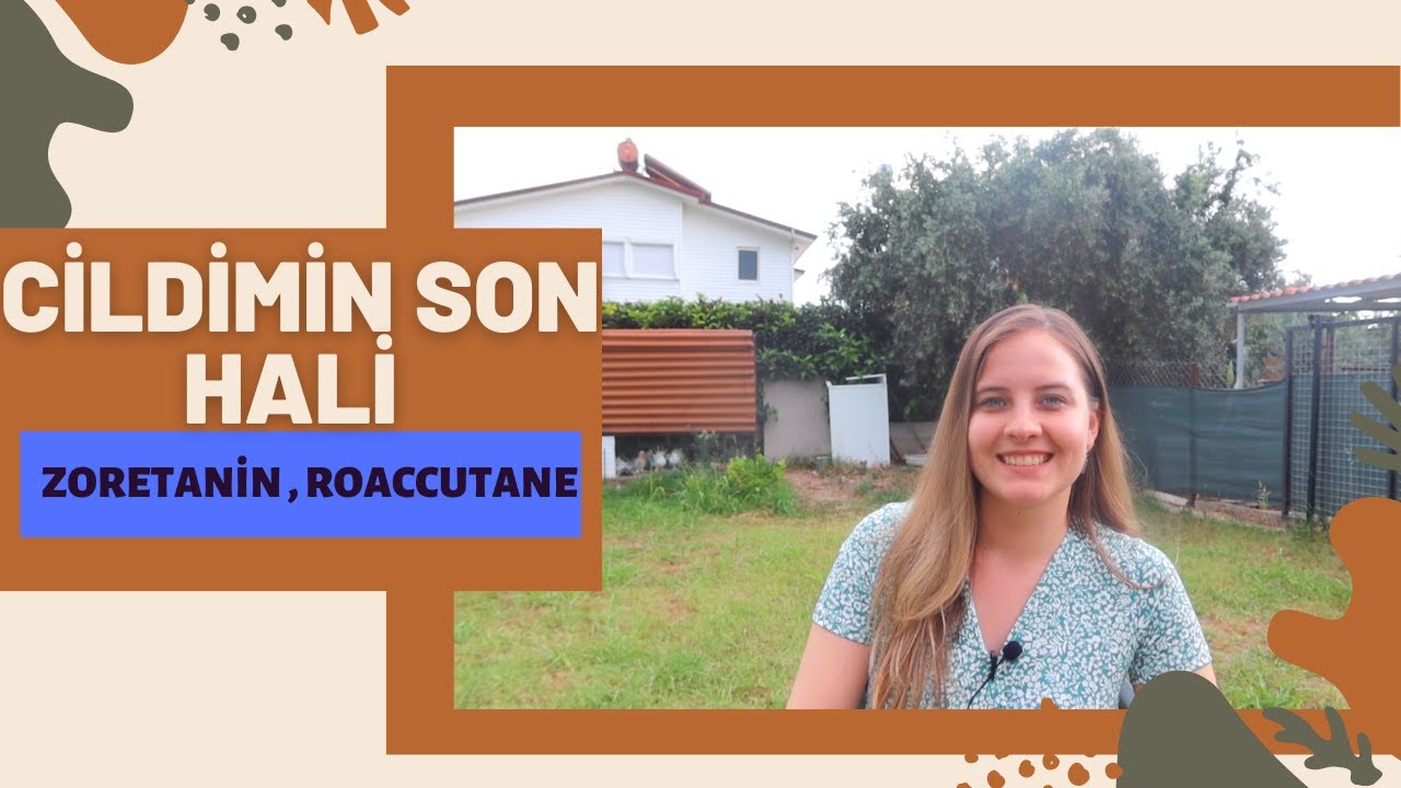 SİVİLCE TEDAVİM | SON DURUM | GÜNCELLEME |SORU- CEVAP
