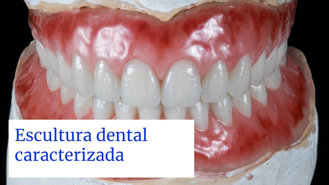 Escultura Gengival e ceroplastia caracterizada com 2 cores