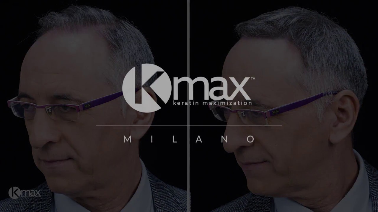 👍REVIEW KMAX MILANO👌 &Pi;ώ&sigmaf; &epsilon;&xi;&alpha;&phi;ά&nu;&iota;&sigma;&alpha; &sigma;&epsilon; 30'' &tau;&eta;&nu; &alpha;&rho;&alpha;ί&omega;&sigma;&eta; &tau;&omega;&nu; &mu;&alpha;&lambda;&lambda;&iota;ώ&nu; &mu;&omicron;&upsilon; 🙏