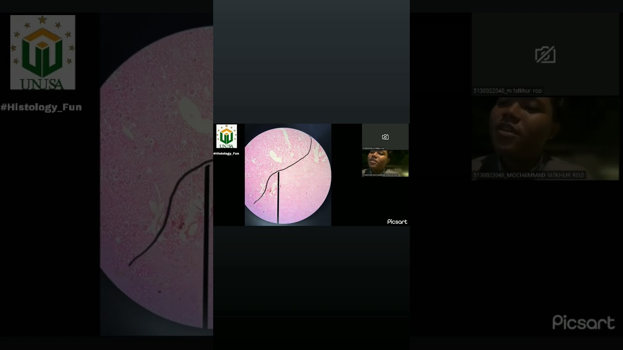 histologi urinalis (medullary rays)