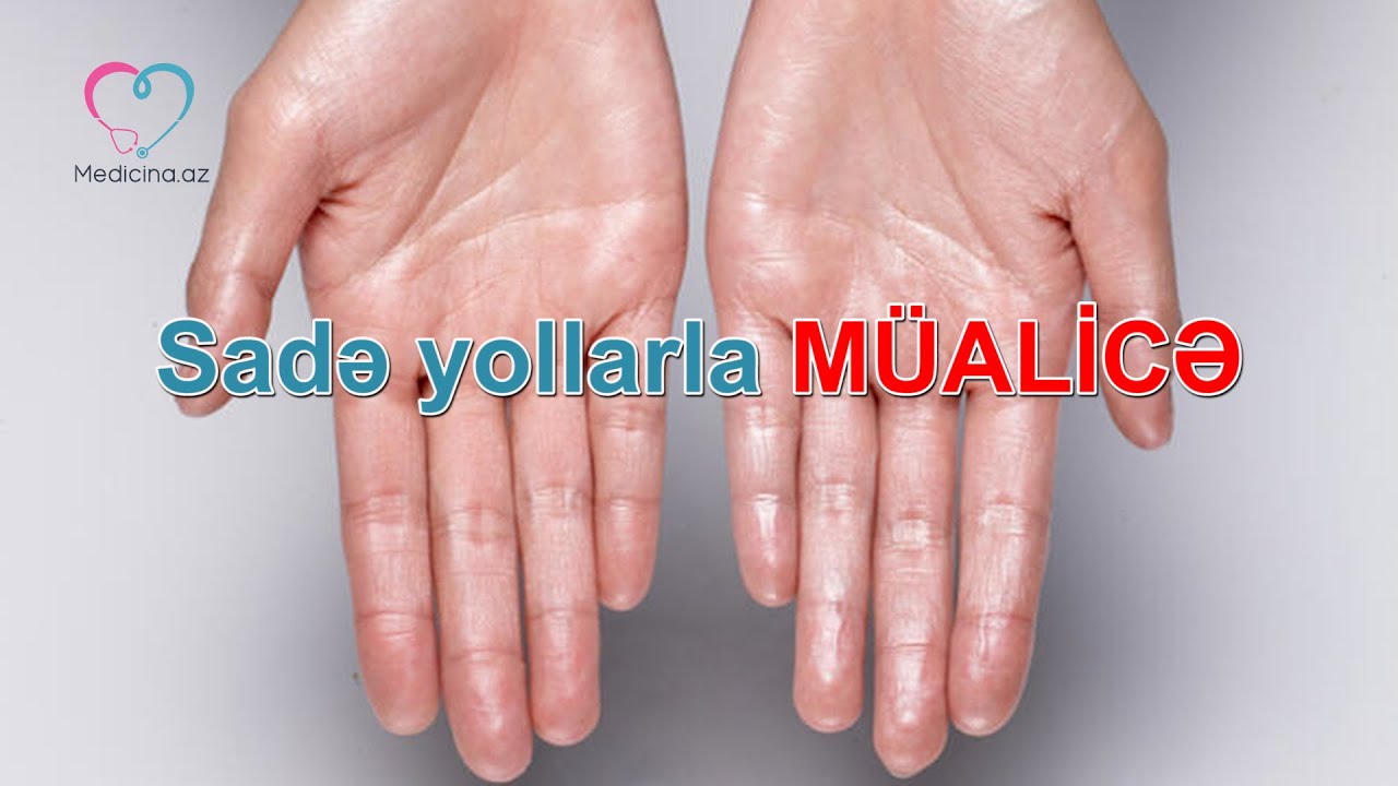 Çox tərləyən əllərə nə etməli?