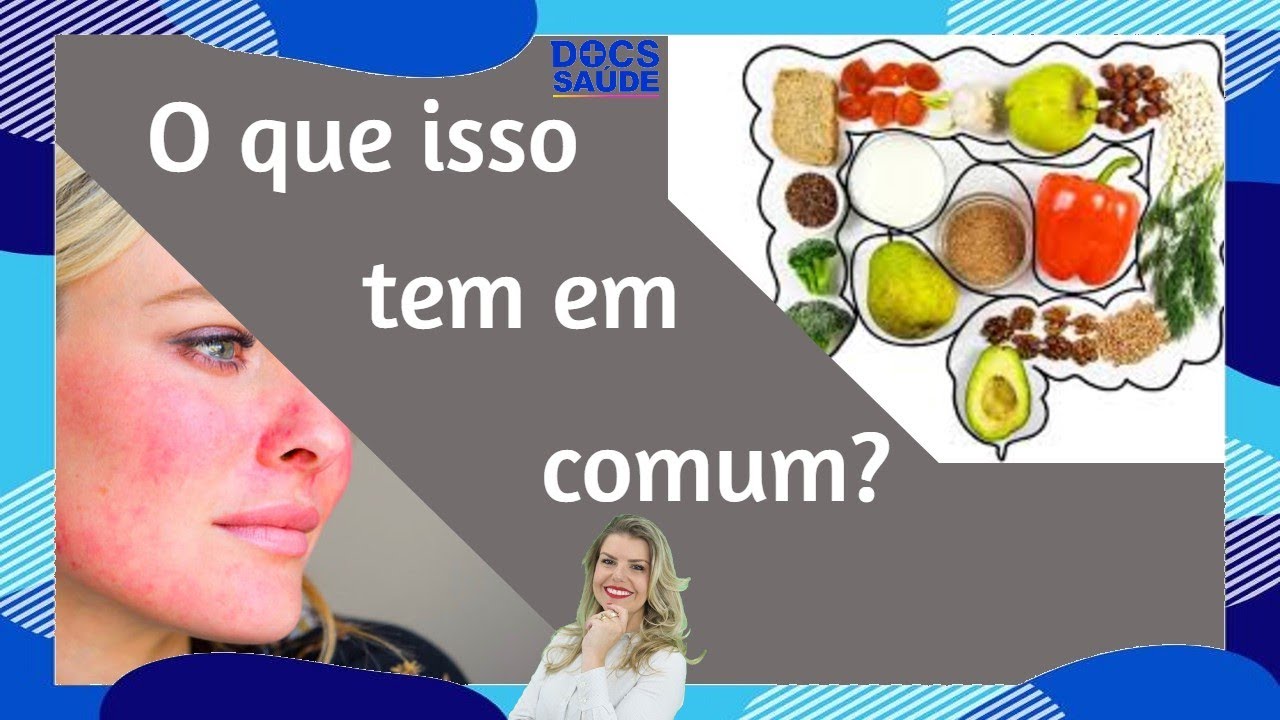 Rosácea e alimentos